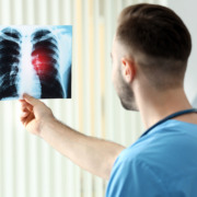 radiotherapy centre - Doctor with x-ray image