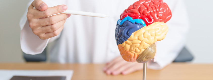 Radiotherapy treatment - doctor with human Brain anatomy model
