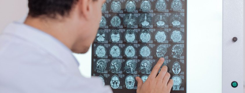 Radiotherapy Centre - octor standing in front of the Z ray image
