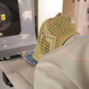 Radiotherapy treatment - Patient Radiation therapy mask showing laser lines for targeting cancer cells in the brain