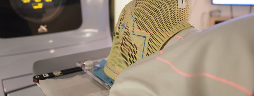 Radiotherapy treatment - Patient Radiation therapy mask showing laser lines for targeting cancer cells in the brain
