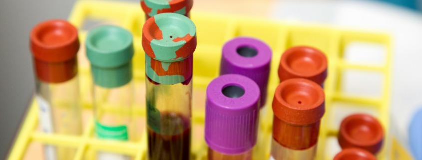Radiotherapy treatment - blood samples