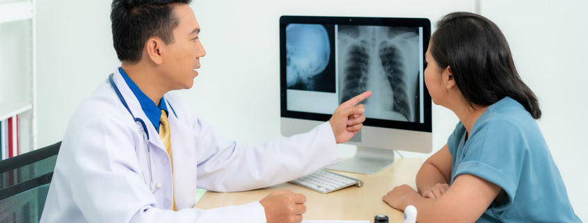stereotactic body radiotherapy - x-ray scan results from doctor