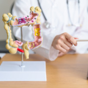 radiotherapy centre - Doctor with human Colon anatomy